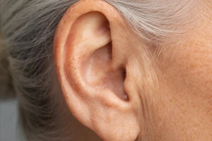 Clear Hearing hearing device shown in-ear, small and discreet.